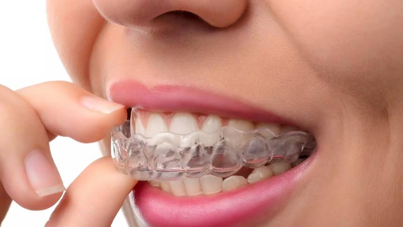 Wireless Orthodontic Treatment